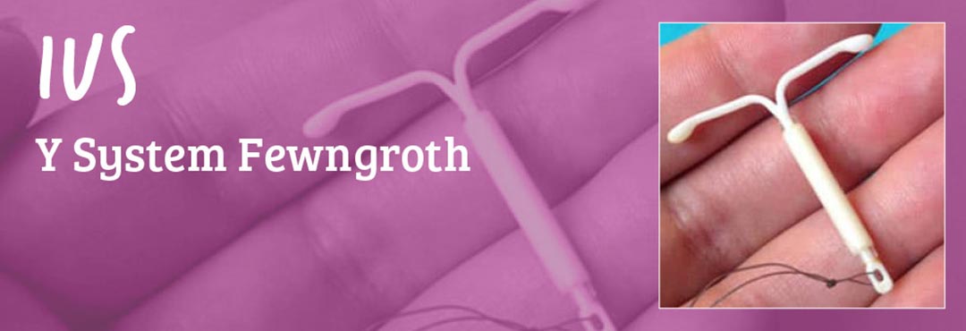 IUS Y System Fewngroth