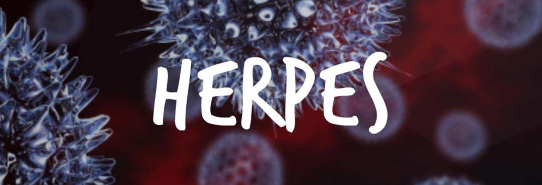 Ynglyn â Herpes